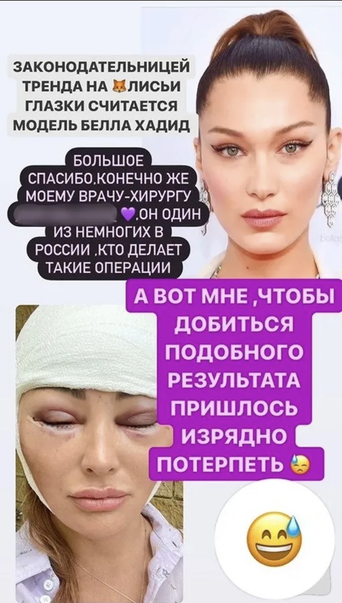 -3-2