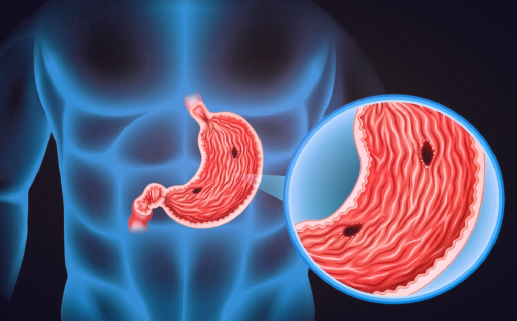 Измененное изображение для оформления статьи