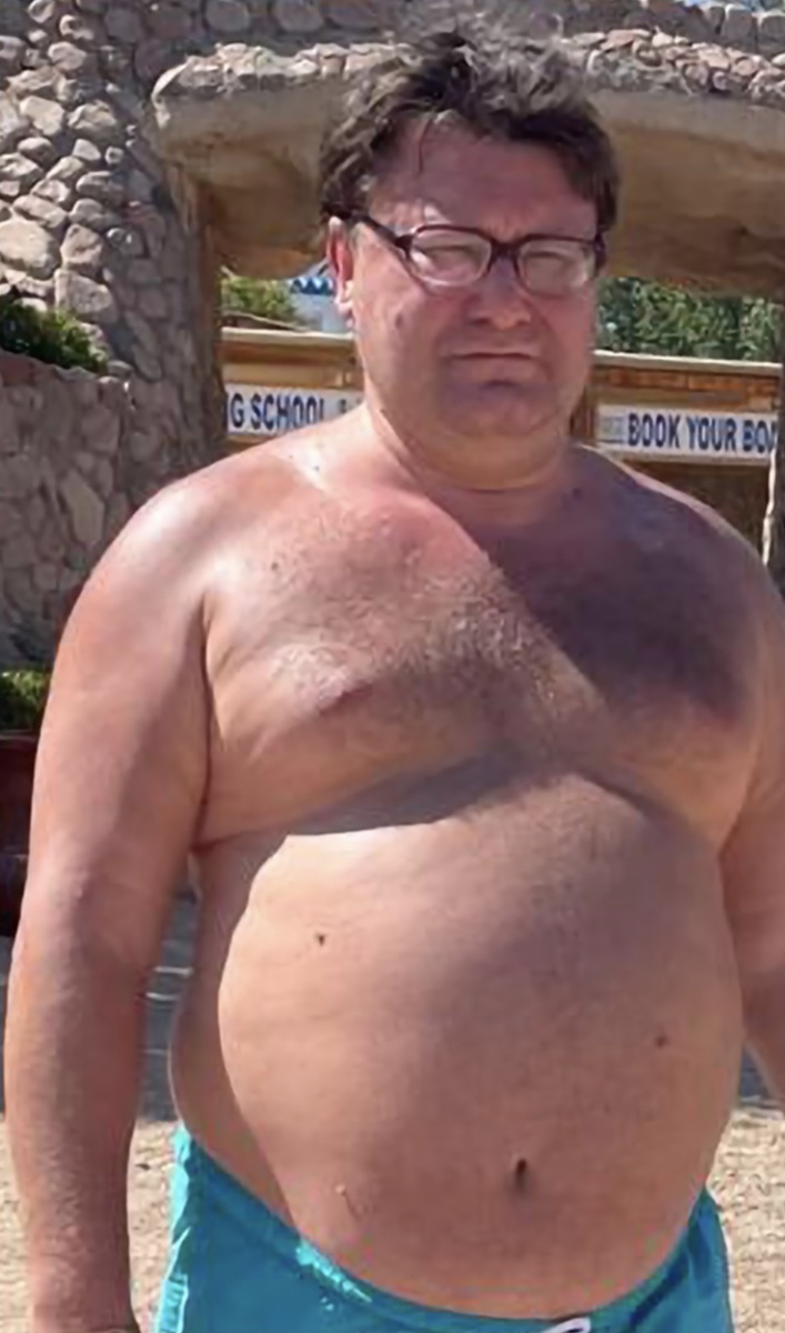 Так я выглядел,  когда устраивал своему желудку ежедневный "all inclusive "