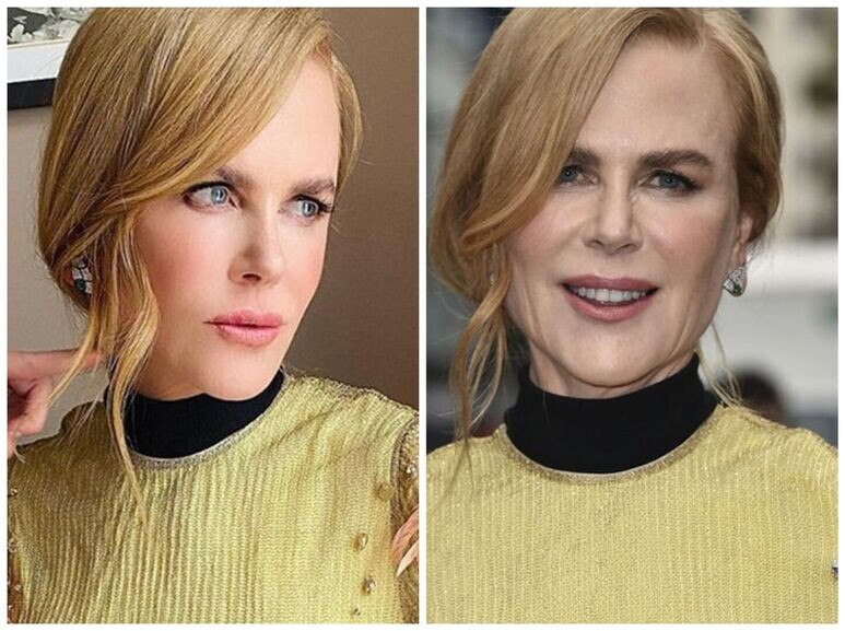     кидман фото