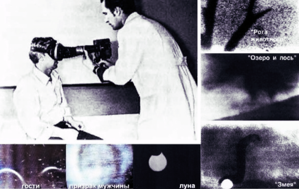 Г. Крохалев и изображения, полученные на пленке, при видениях и галлюцинациях от разных пациентов