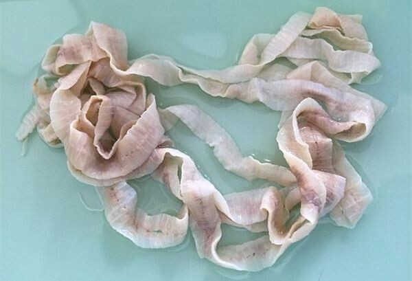 Широкий лентец может достигать более 10 метров в длину