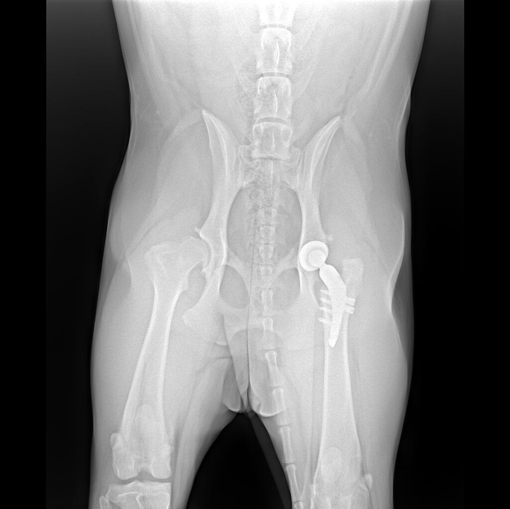 левая сторона - протез/правая сторона - разрушенный сустав, который под замену в 25м году.