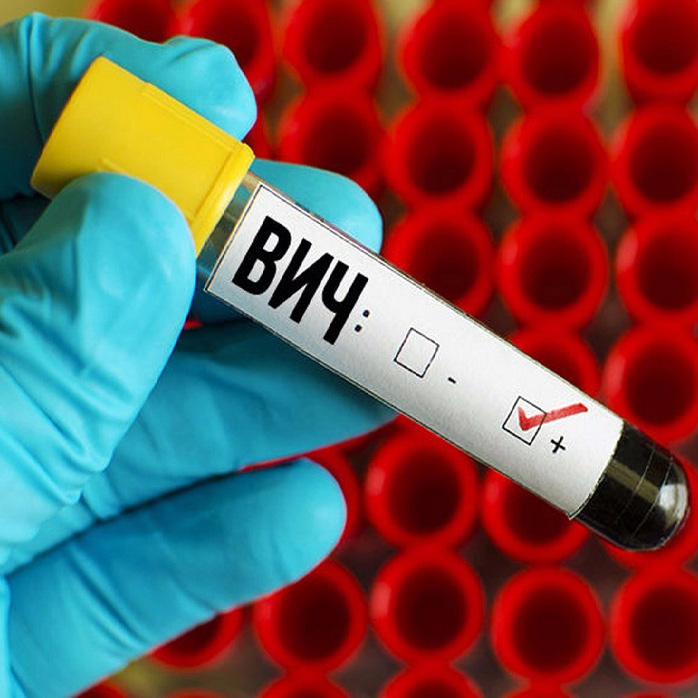 Иркутскую область назвали регионом с одной из худших обстановок по распространению ВИЧ-инфекции. Были проанализированы данные за прошлый год, по их итогам в России проживало 1,2 миллиона человек с ВИЧ. Почти 60 процентов из них – на Урале и в Сибири. Об этом сообщает «Коммерсантъ» со ссылкой на экспертов проекта «Если быть точным».