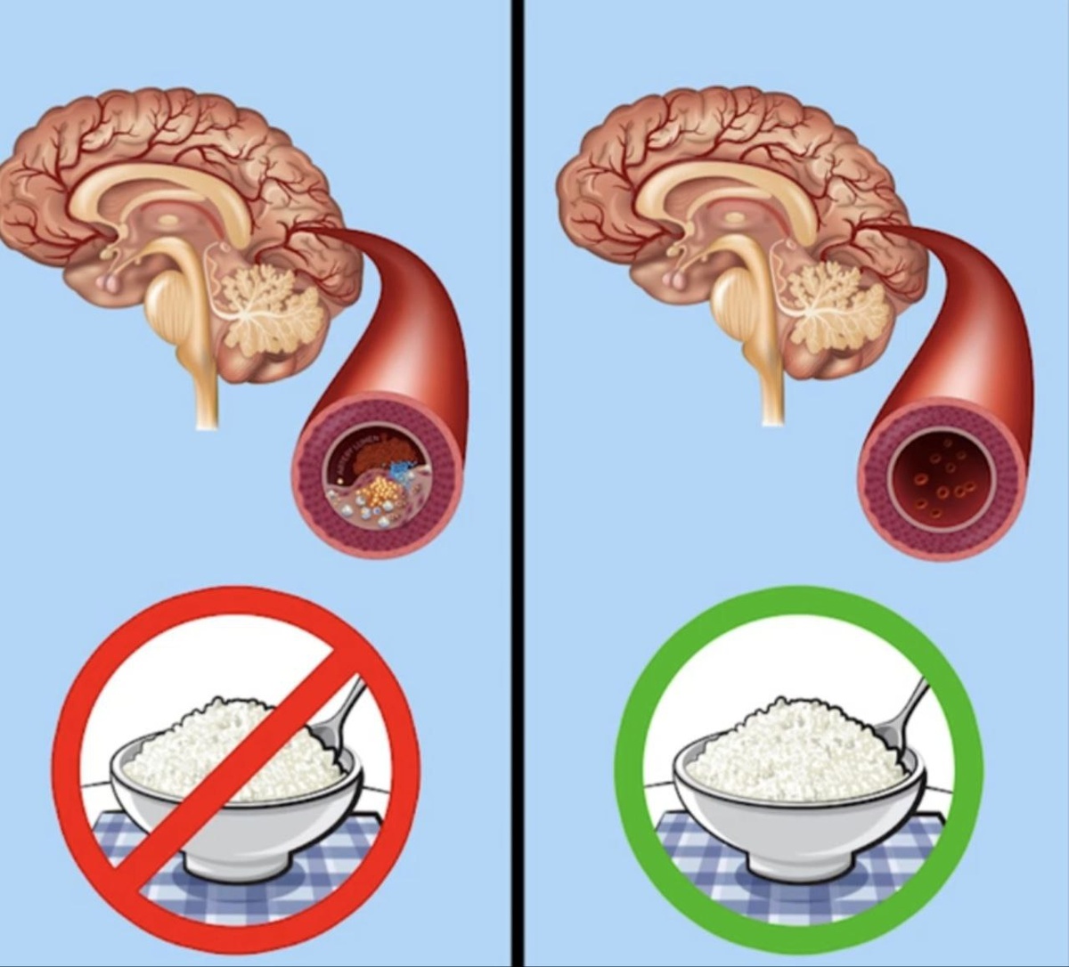 Изменения, вызванные диетой#