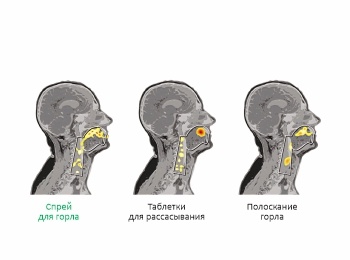 Распределение препарата на слизистой полости рта и горла в момент введения (слева) и динамика его последующего сохранения на слизистой горла (справа) при разных путях введения