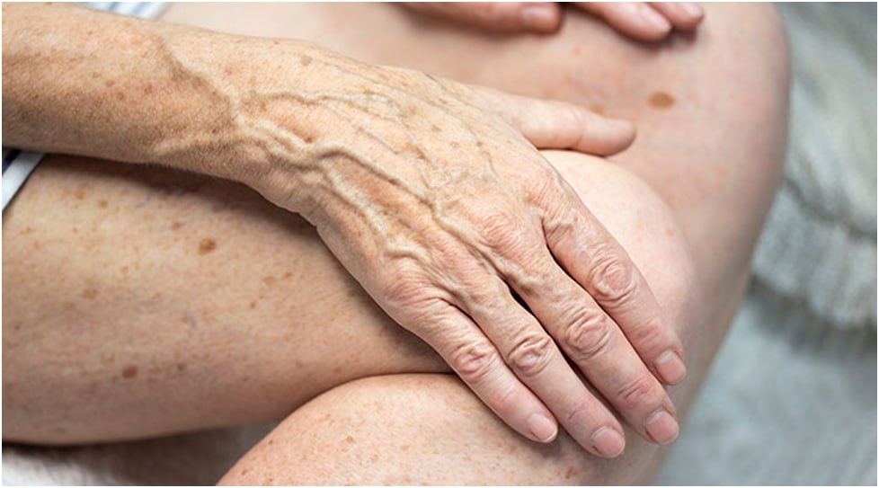 пятна на теле / коллаж Другой Кухни