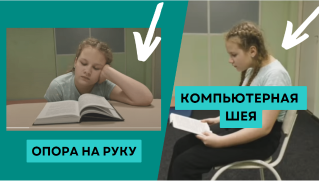 Наклон головы в одну сторону, усиленные изгибы позвоночника, ассиметрия плеч и лопаток - это явные начинающиеся признаки нарушения осанки 