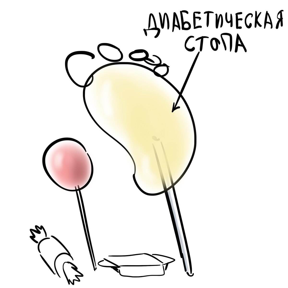 Диабетическая стопа