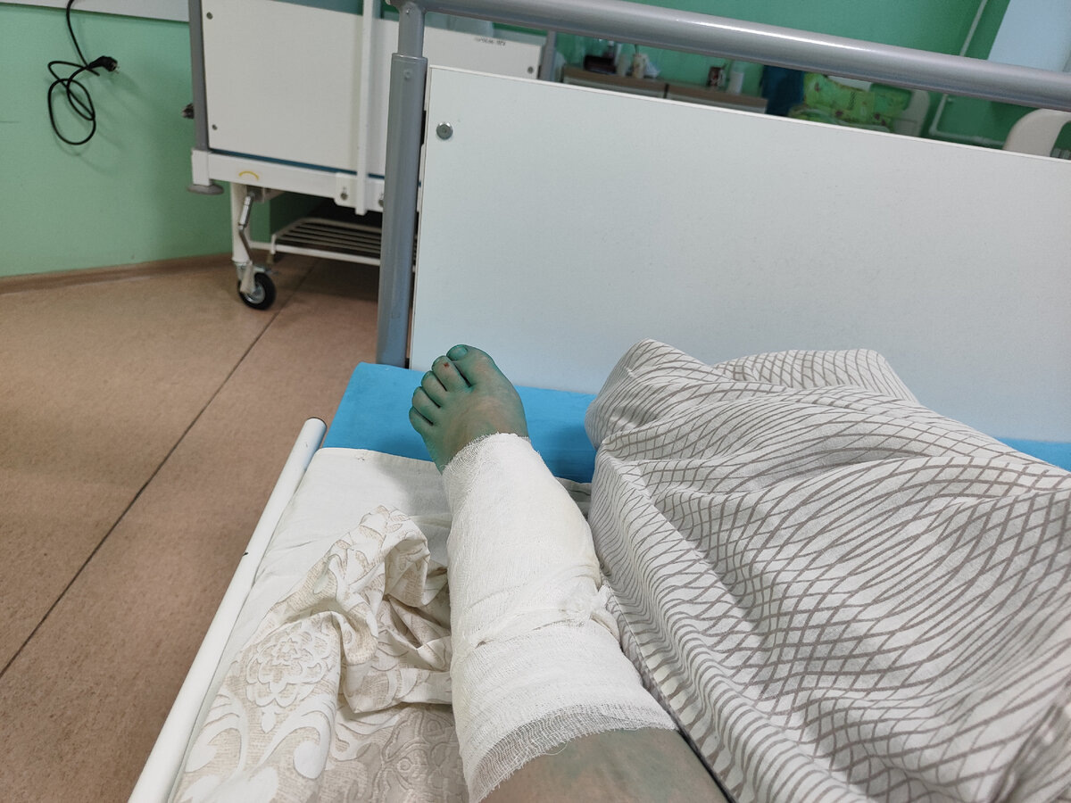 нога халк крушить)