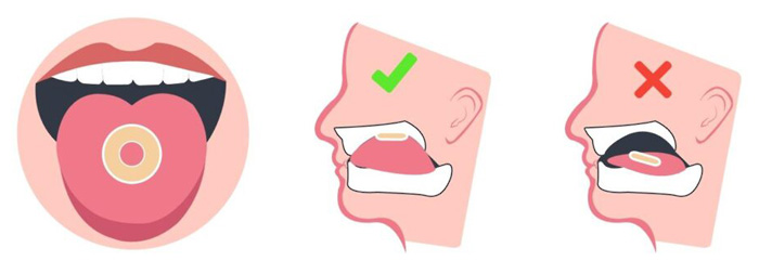Упражнения мьюинг