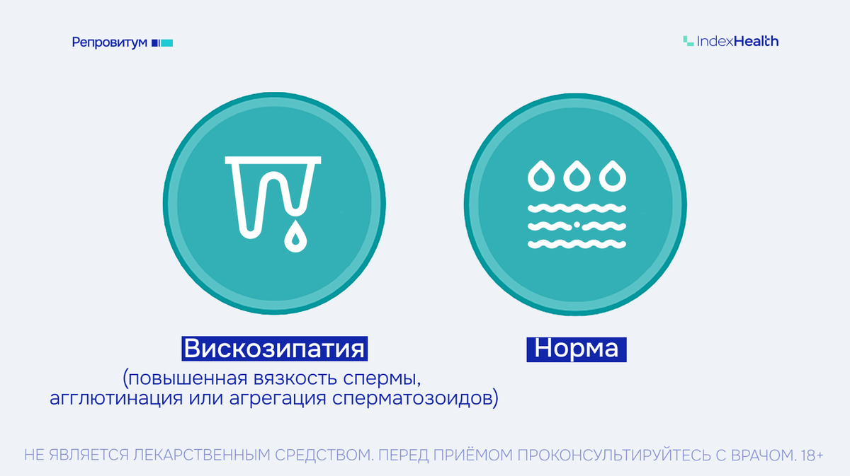 Вискозипатия: повышенная вязкость спермы