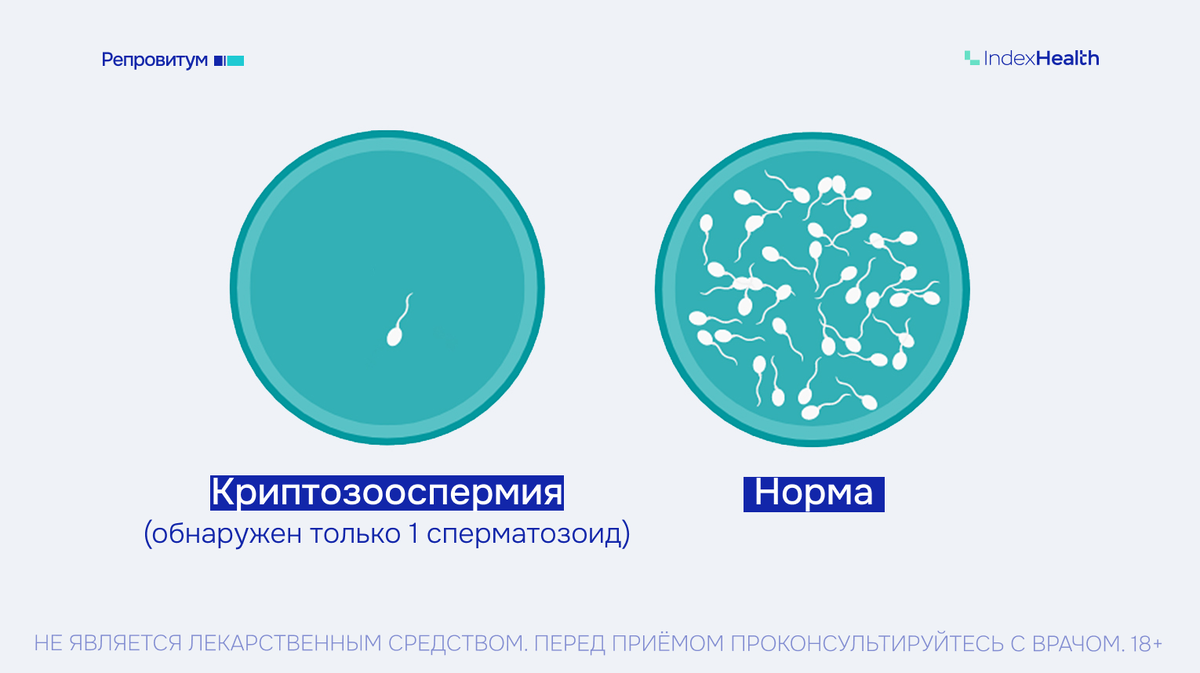 Криптозооспермия