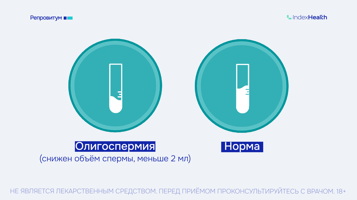 Олигоспермия