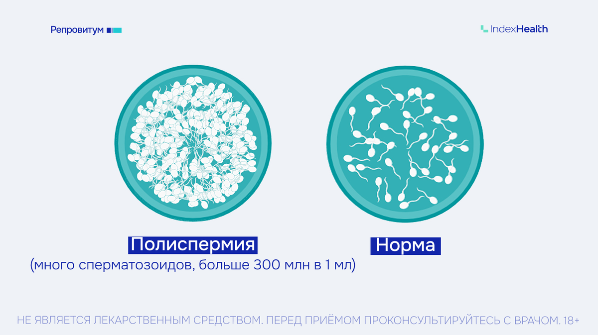 Полиспермия
