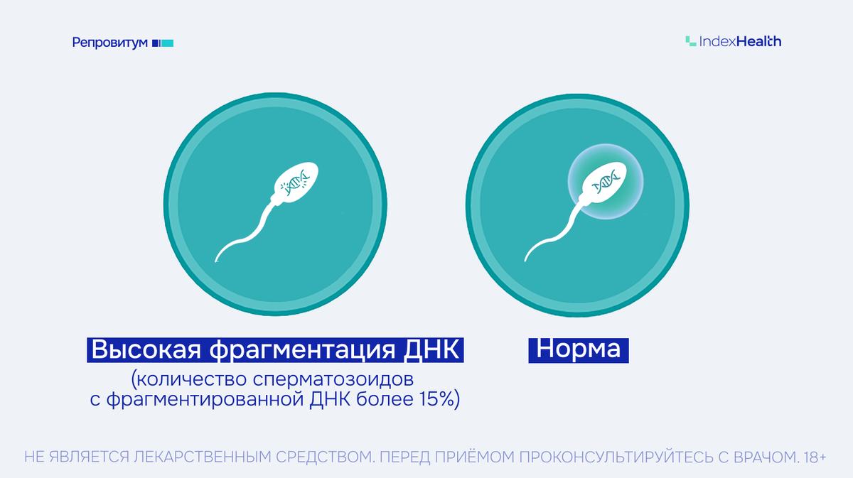 Фрагментация ДНК сперматозоидов
