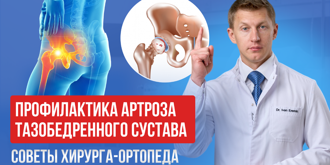 Профилактика артроза тазобедренного сустава: советы хирурга-ортопеда