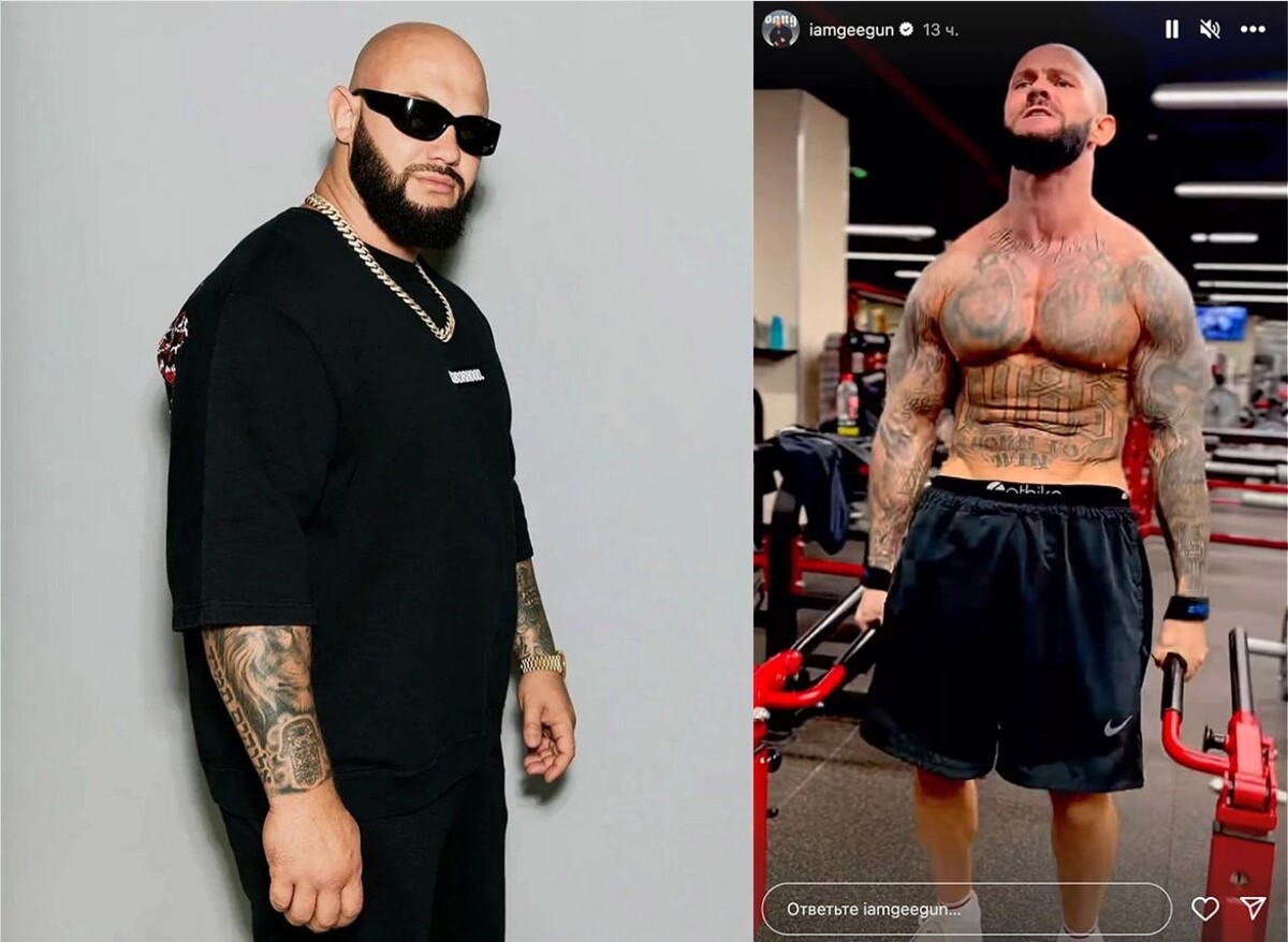 Джиган до и после пластической операции