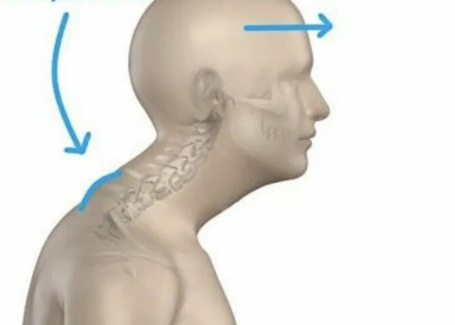 Постоянное сидение за компьютером делает шея выдвинутой вперед, появляется холка