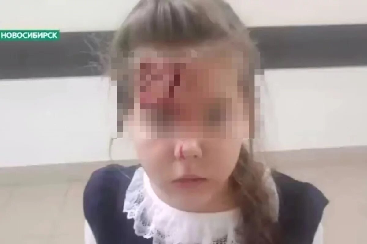    Второклассница расшибла лоб о колонну в одной из школ Новосибирска