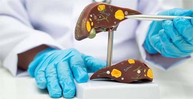 Боль в правом подреберье может сигнализировать о серьезных заболеваниях