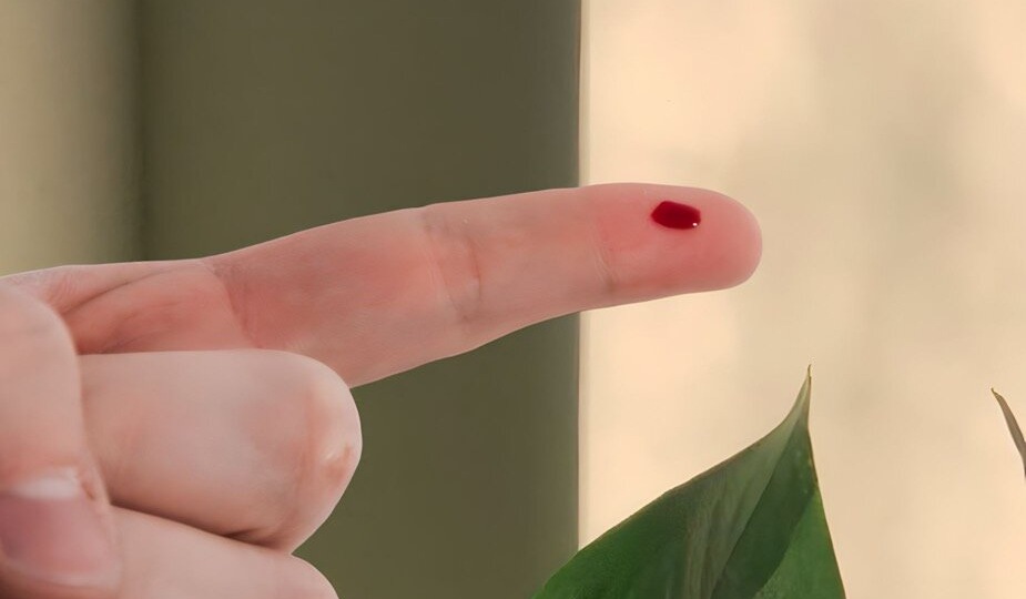 Как понять, что у вас густая кровь: 7 симптомов, которые