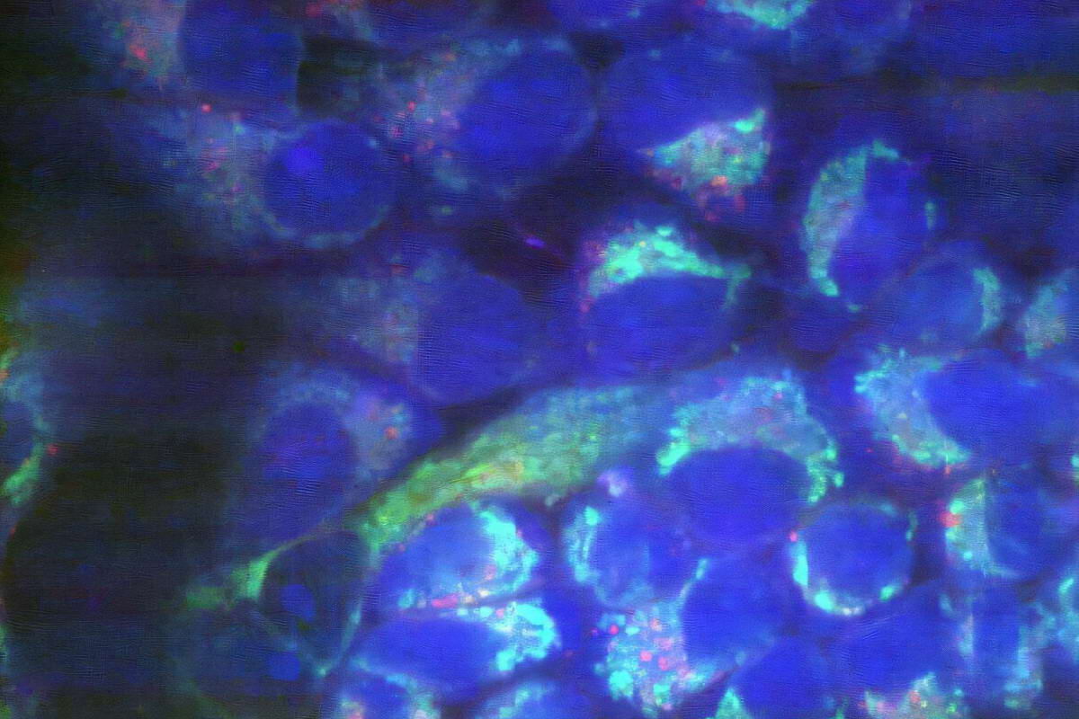 Рамановская микроскопия: химическая визуализация с высоким разрешением