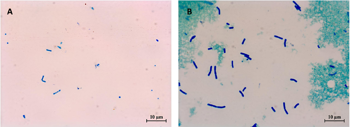 Лактобациллы в молоке без наночастиц селена (А) и с биологически активной добавкой на их основе (В). Источник: Blinov et al. / Colloids and Surfaces A: Physicochemical and Engineering Aspects, 2024