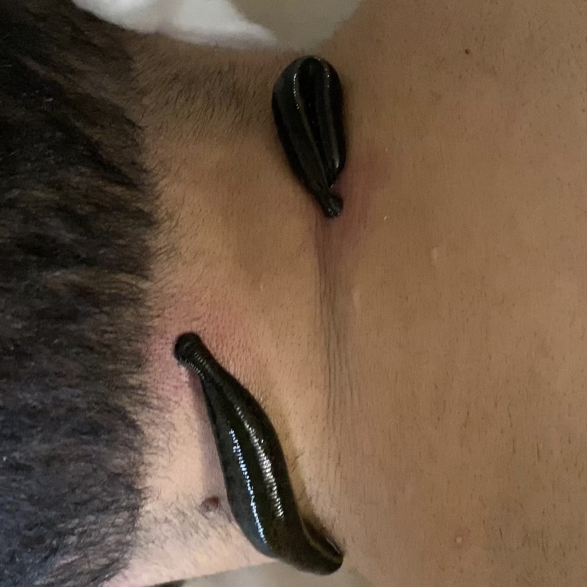 Именно здесь отсутствует кость, что делает это место особенно доступным для воздействия. Фото: собственность автора статьи