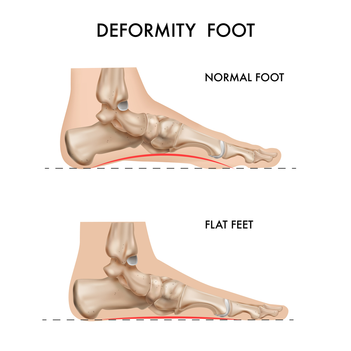 https://www.freepik.com/free-vector/set-human-foot-bone_19399334.htm#fromView=search&page=1&position=6&uuid=8fae42cc-67af-46a3-9141-e9ad7c3f90d2&new_detail=true