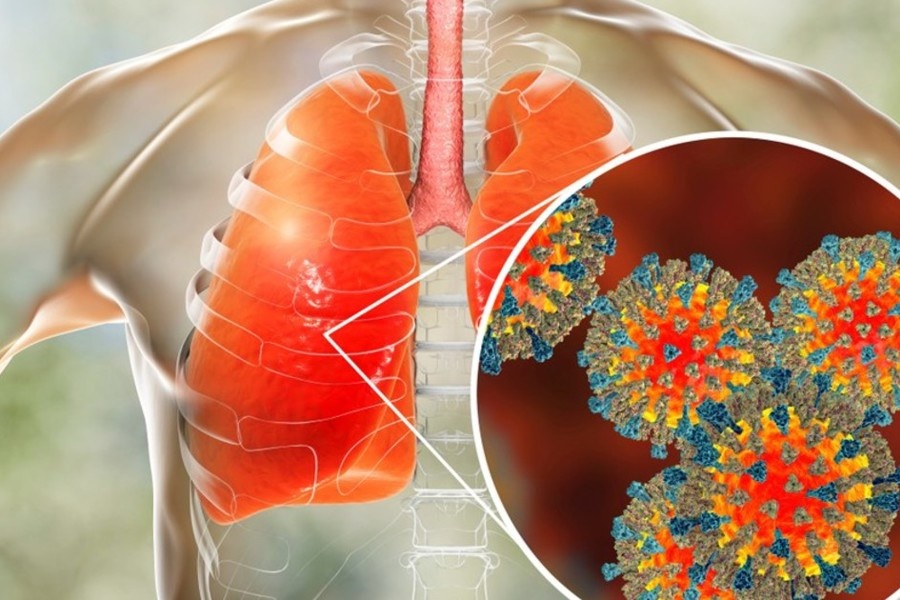 Фото взято из интернета