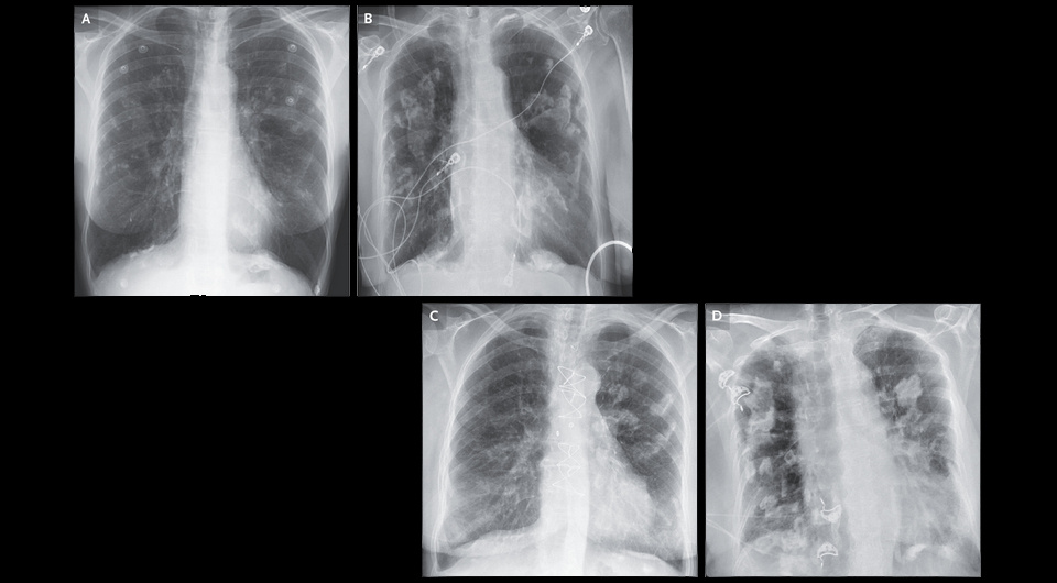   Shawn Chillag, Richard Scott Morehead / NEJM, 2024