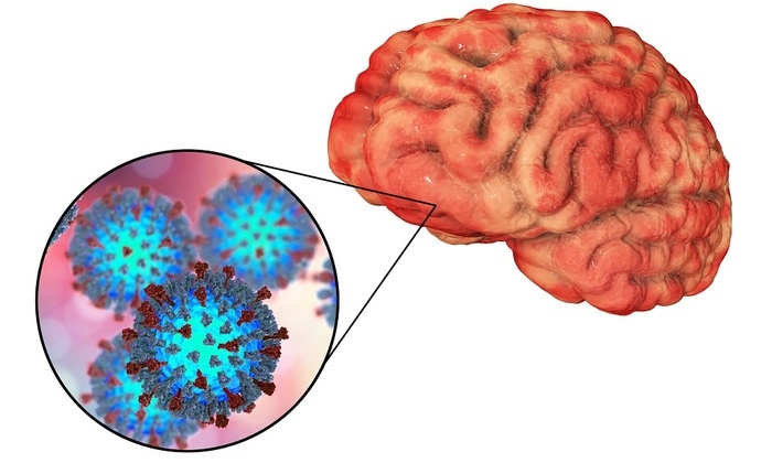    Не ковыряйся в носу так можно и Альцгеймера заработать!
