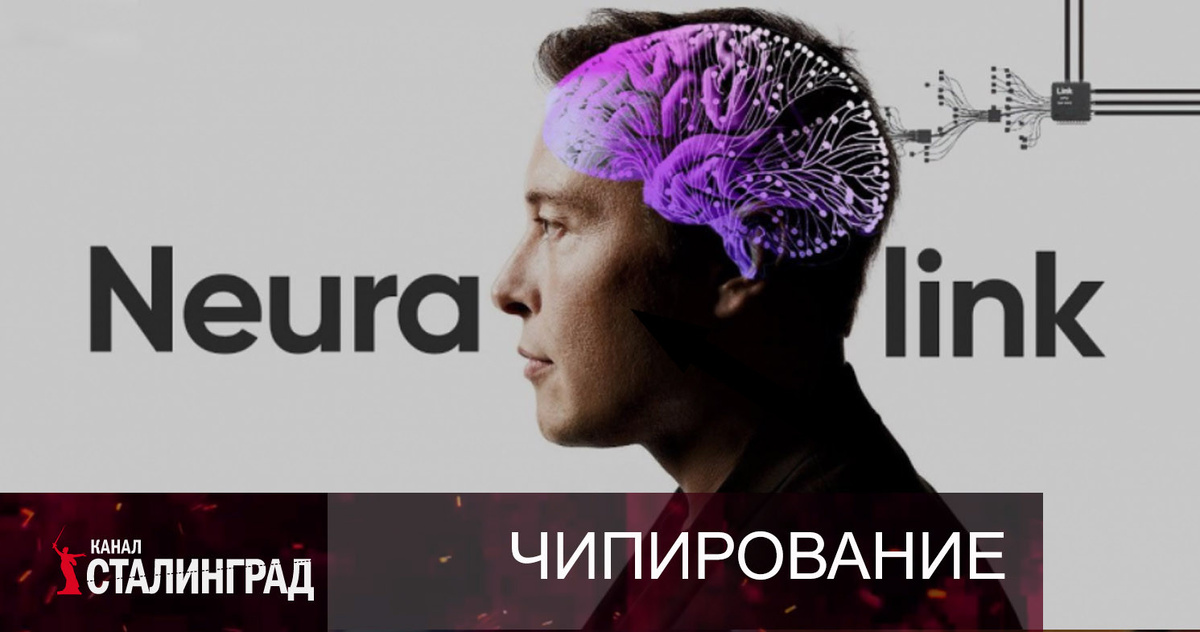    Жизнь с мозговым чипом Neuralink: плюсы и минусы от первого пользователя
