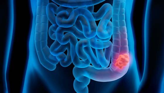     Фото: Johns Hopkins Medicine