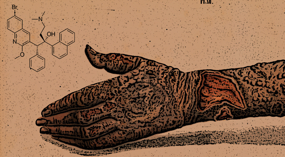   N + 1; Om spedalskhed ... Atlas / udgivet efter foranstaltning of den Kongelige Norske Regjerings Department for det Indre. Tegningerne udförte af J.L. Losting. / Danielssen, D. C. (Daniel Cornelius), 1847 / Wellcome Collection / CC-BY-4.0; Ed (Edgar181) / Wikimedia Commons / Public Domain