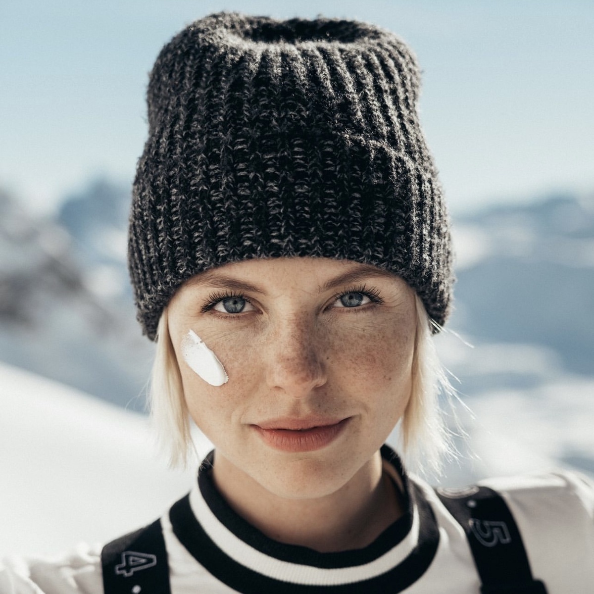 В зимний период это может возникать, например, из-за постоянного ношения головных уборов.