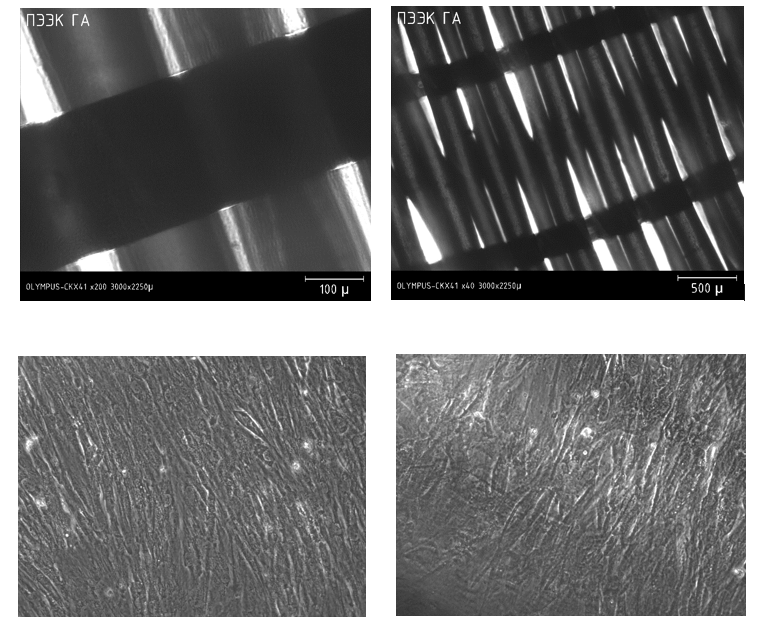 Фото каркасов, заселенных клетками на 21 сутки