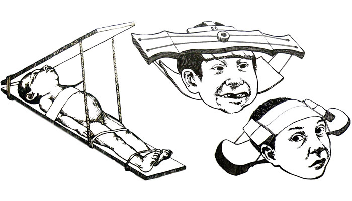 Модификация черепа у индейцев майя. Фото: wikipedia.org