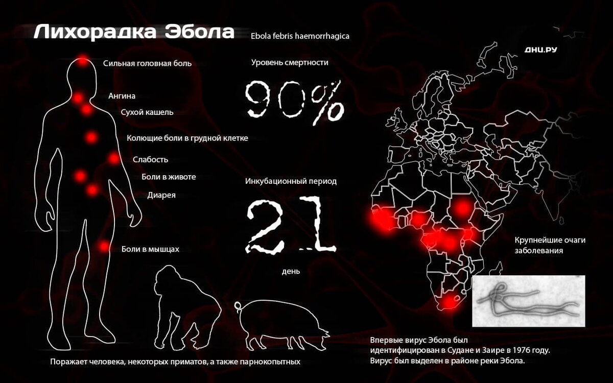 Болезнь аддисона кожные проявления. 6 the disease. 6 the disease. Атопического дерматита у детей. 6 the disease.
