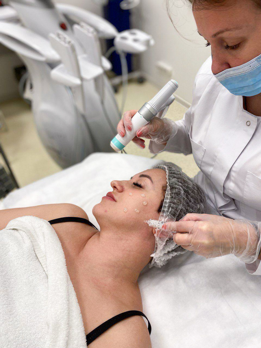 SMAS лифтинг на аппарате Ультраформер