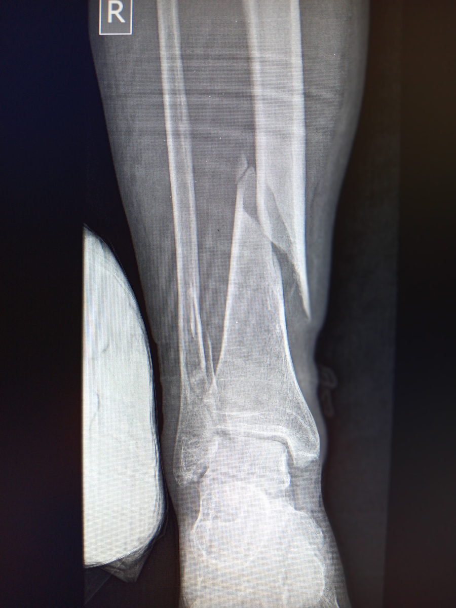 Такое не перебинтуешь