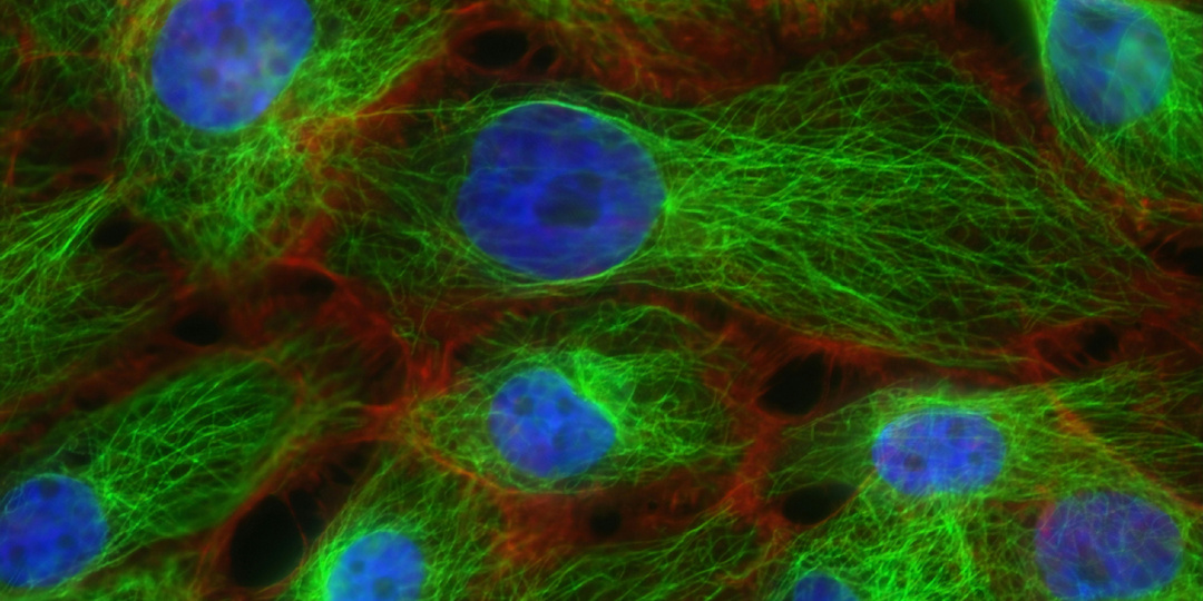 Корейские учёные научились превращать раковые клетки в ЗДОРОВЫЕ