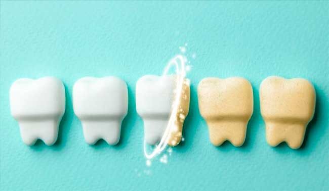 Миф 10. Белые зубы всегда здоровее