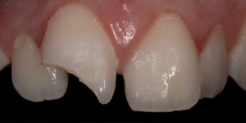 Фото нашего пациента после травмы. 