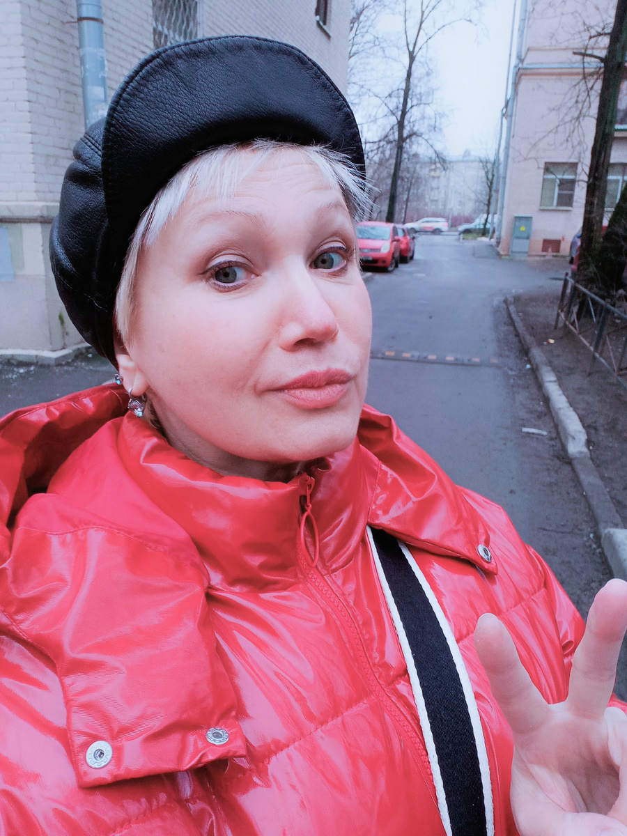 Открывать рот страшно до сих пор. Зубы походят на те, что продают в магазинах приколов