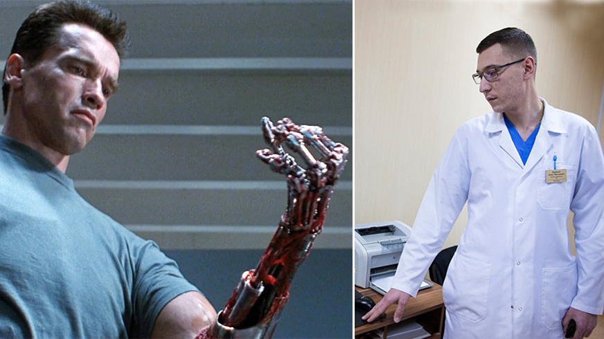 Собственно сам Терминатор и Денис Корнилов, заведующий микрохирургическим отделением ИОКБ