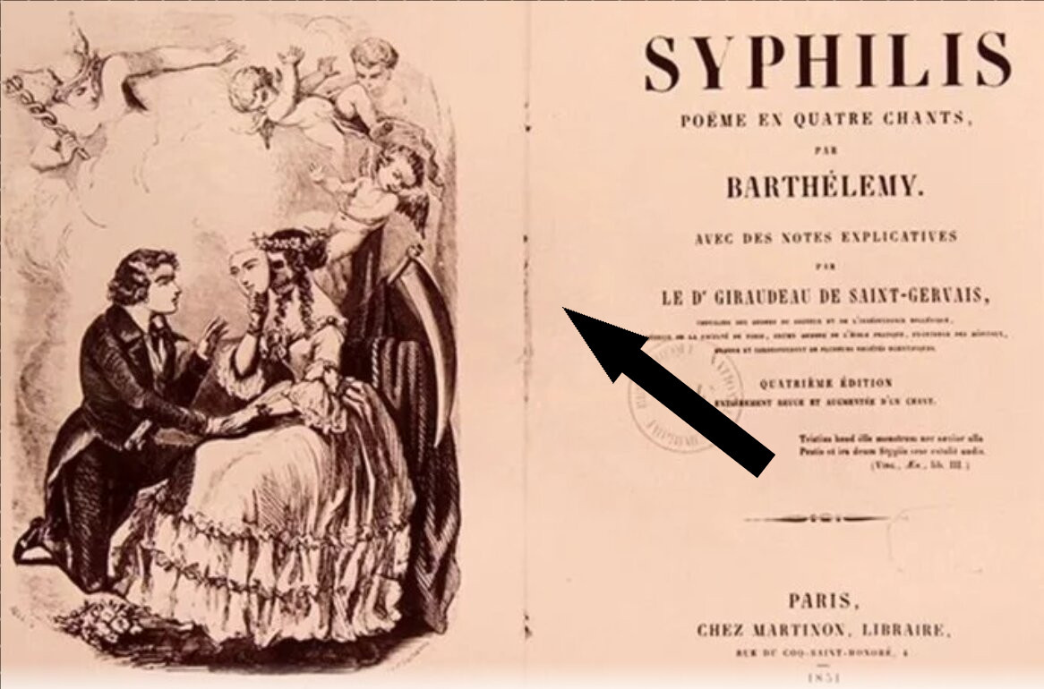    Сифилис: модная болезнь из Америки