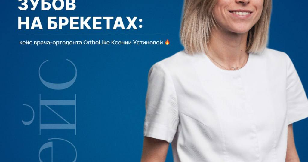 Исправление скученности зубов на брекетах: кейс стоматолога-ортодонта OrthoLike Ксении Устиновой