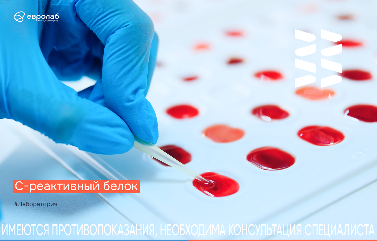 С-реактивный белок (СРБ)